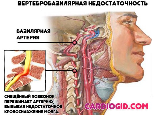 Причины и последствия пониженного артериального давления